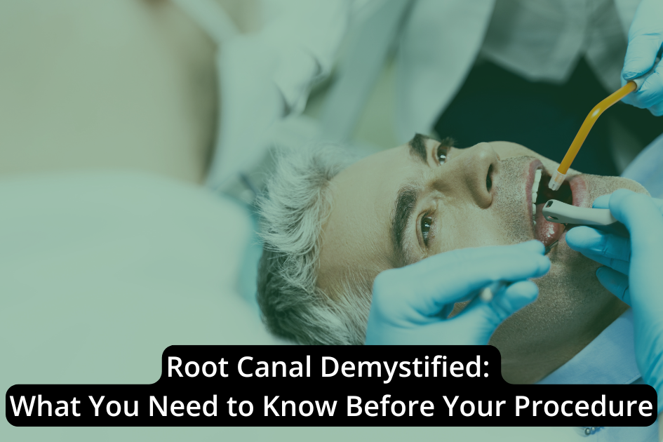 Root Canal Demystified: What You Need to Know Before Your Procedure