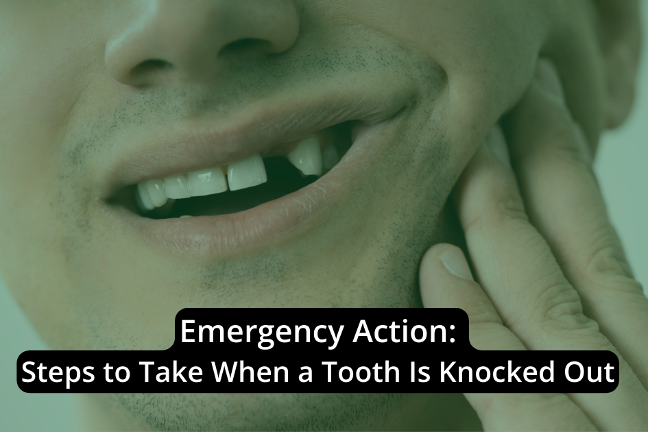 Emergency Action: Steps to Take When a Tooth Is Knocked Out