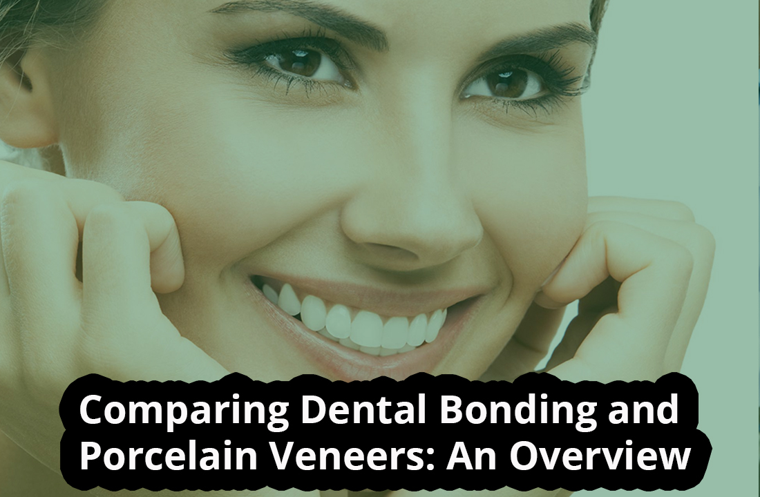 Comparing Dental Bonding and Porcelain Veneers: An Overview