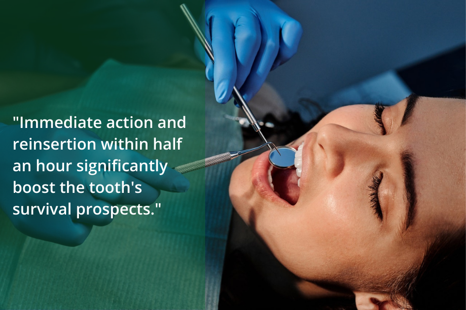 A woman is brushing her teeth with the words immediate action, as knocking out a tooth requires quick restoration for better survival chances within half an hour.