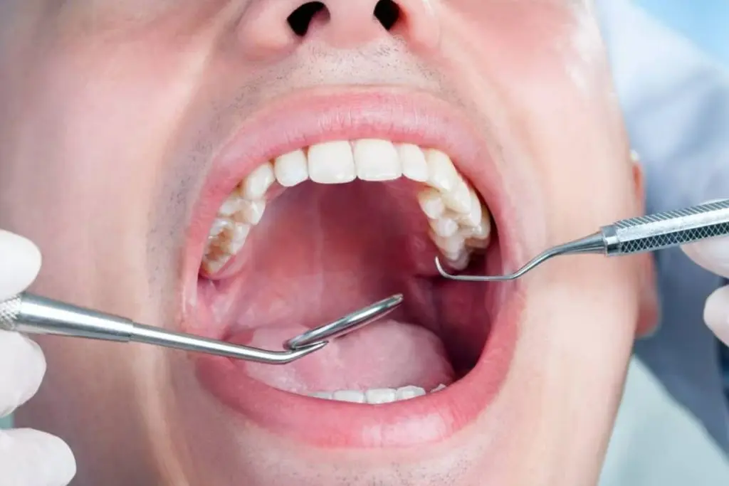Emergency Dental Care or The ER for Dental Problems: Deciding Between the Two — Mallard Creek Dental, Taylor TX
